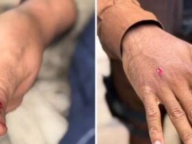 Macaco-prego invade casas, ingere álcool e medicamentos e deixa cinco feridos em Salvador